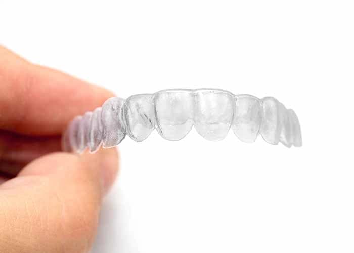 The Most Valuable Investments You Can Make in Your Smile: Invisalign